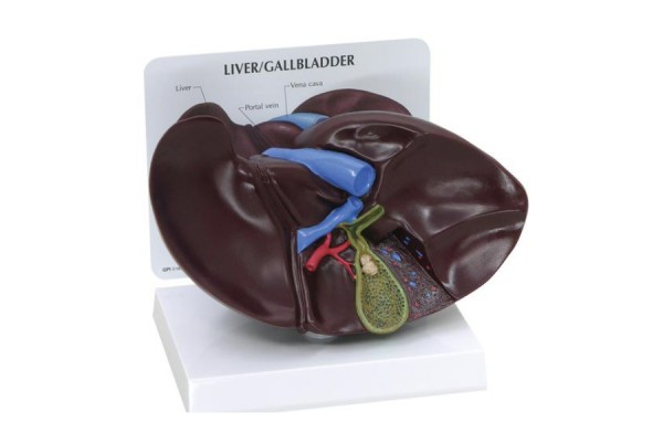 model wątroby/pęcherzyka żółciowego z kamieniami żółciowymi - 1019551 3b scientific modele anatomiczne 2